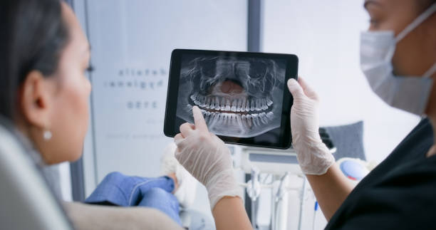 Licensed Tooth Extraction service in California, MD - Smile Center Dentistry